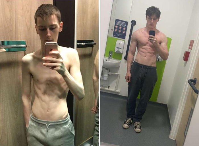 Así vencí a la anorexia: esta fue mi transformación en 2 años