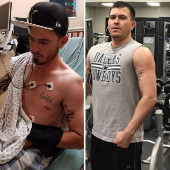 ‘The Addict’s Diary’: 30 Powerful Before & After Transformations Of Drug Addicts (New Stories)