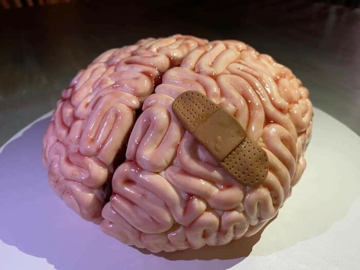 Mi hermana ha hecho una tarta de felicidades-por-cumplir-un-año-desde-la-operación-de-cerebro