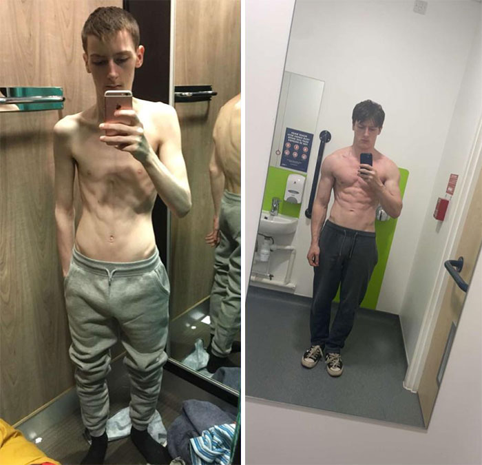 Venciendo a la anorexia. 2 años de transformación