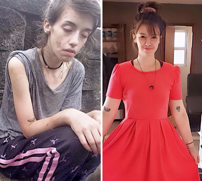 Esta es una imagen actualizada de mi recuperación. Llevo 19 meses limpia y por fin empiezo a ver la belleza de la vida de nuevo
