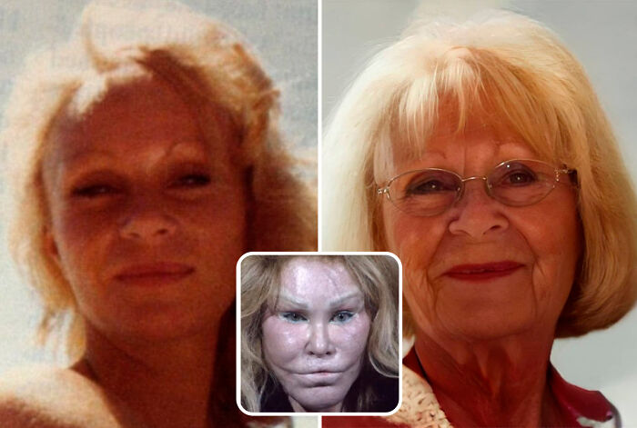 Jocelyn Wildenstein, 81 años