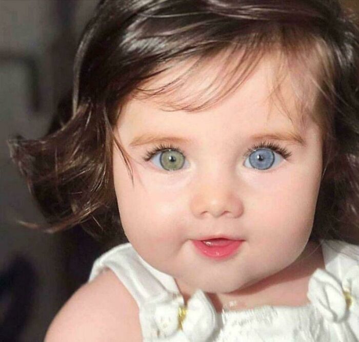 La heterocromía es una diferencia en la coloración, normalmente del iris, pero también del pelo o la piel