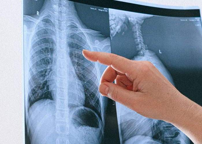 La gente comparte 25 datos nada divertidos que desearían no haber sabido
