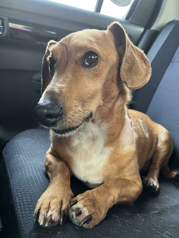 Mi muchacho acaba de ser operado con éxito y ya no tiene cáncer