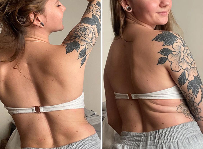 This Woman Goes Viral Online For Reminding People What Real Bodies Look Like By Sharing These 30 Side-By-Side Pictures (New Pics)