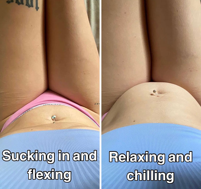 This Woman Goes Viral Online For Reminding People What Real Bodies Look Like By Sharing These 30 Side-By-Side Pictures (New Pics)