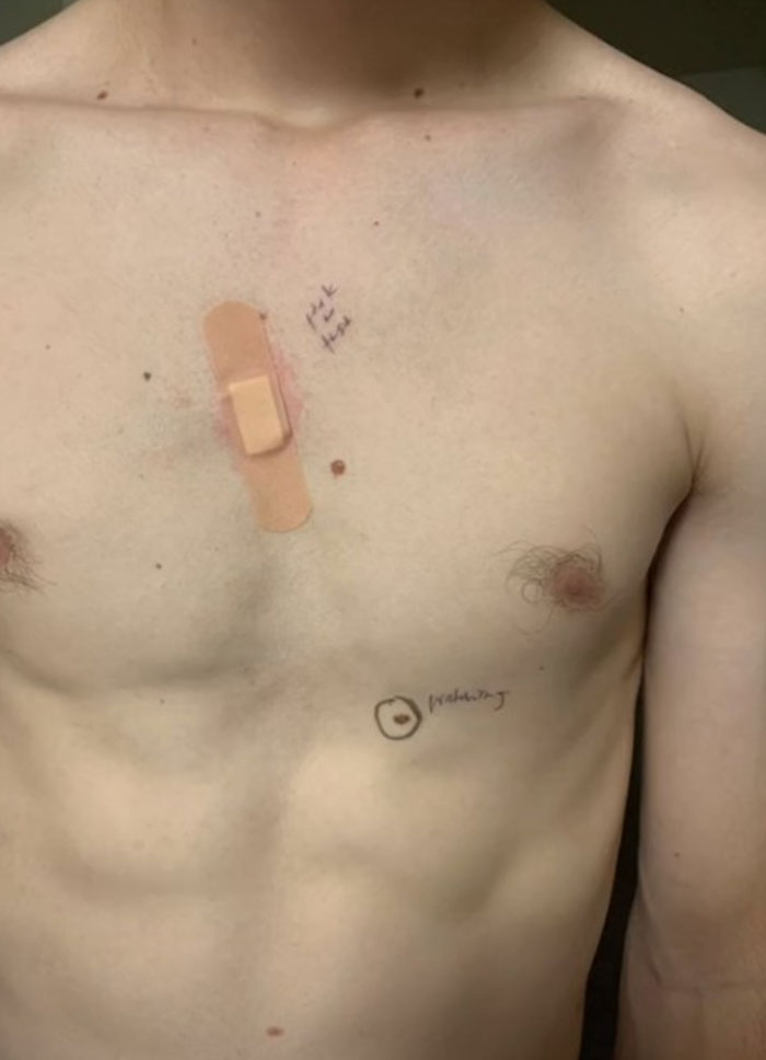 Esta esposa marcó los lunares de su marido antes de que fuera al médico y volvió con notas en su cuerpo