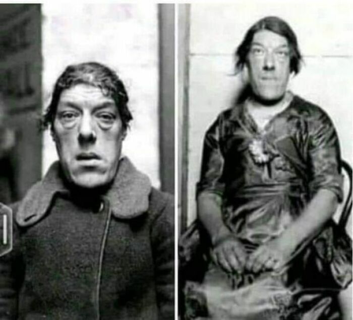 Cuando su esposo falleció y se quedó sin un sostén familiar, Mary Ann Bevan decidió entrar a un concurso y ganó el ofensivo título de “la mujer más fea del mundo”. Fue contratada por un circo y soportó las burlas de la gente para poder criar a sus hijos y darles una mejor vida
