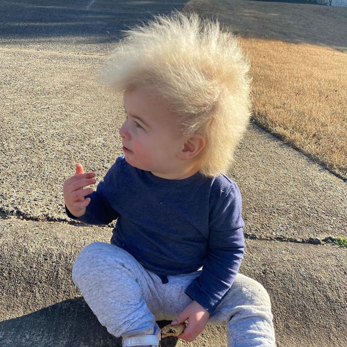 A este alegre niño se le diagnosticó el síndrome del cabello impeinable