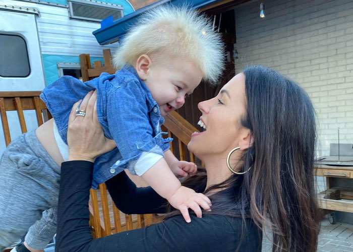 A este alegre niño se le diagnosticó el síndrome del cabello impeinable