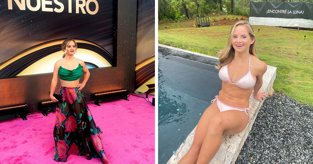 Esta modelo de 24 años cumple su sueño de convertirse en la primera modelo de Victoria’s Secret con síndrome de Down