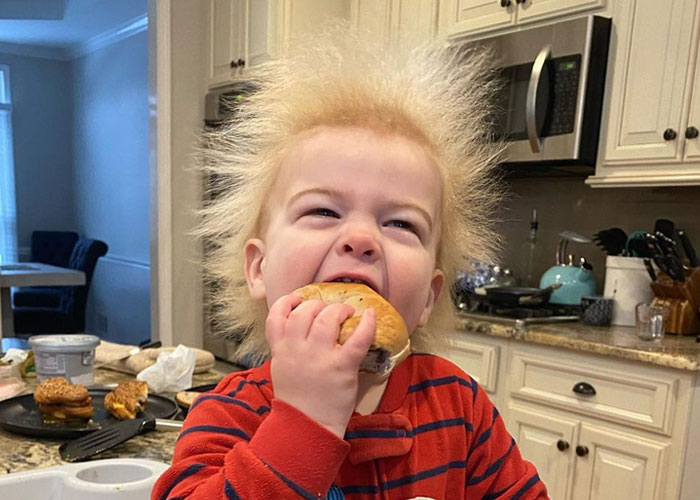 A este alegre niño se le diagnosticó el síndrome del cabello impeinable