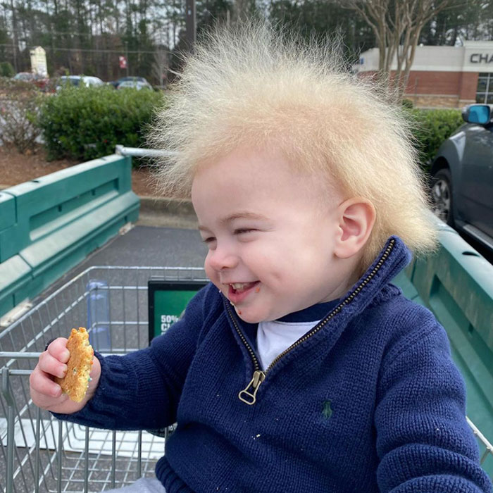 A este alegre niño se le diagnosticó el síndrome del cabello impeinable