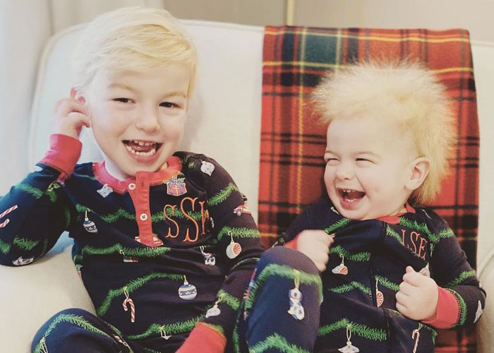 A este alegre niño se le diagnosticó el síndrome del cabello impeinable