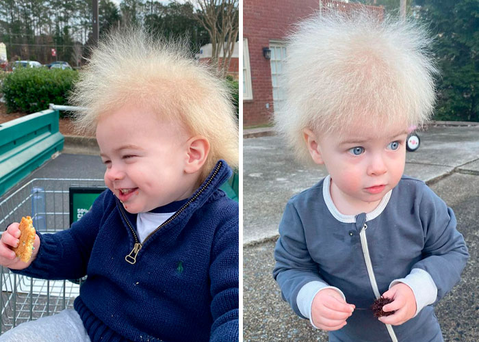 A este alegre niño se le diagnosticó el síndrome del cabello impeinable