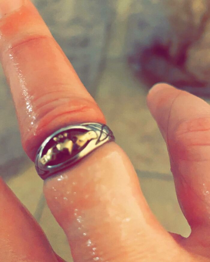 Mamás embarazadas: ¡escuchen! No olviden quitarse los anillos antes del tercer trimestre