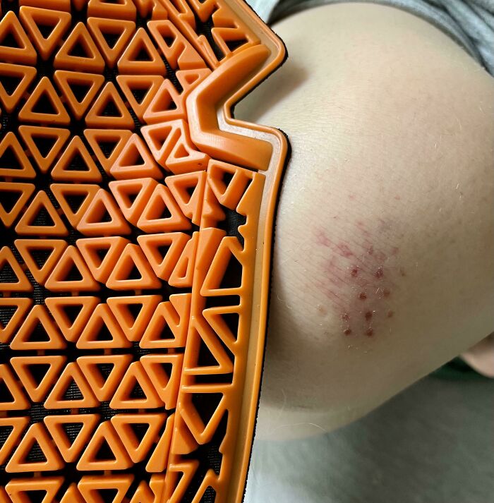Tuve un accidente de moto y mi equipo hizo un trabajo tan bueno que mi única lesión en la piel fue una huella de la protección de la rodilla