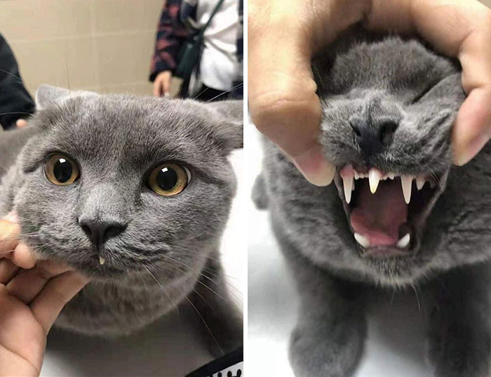 Dientes supernumerarios