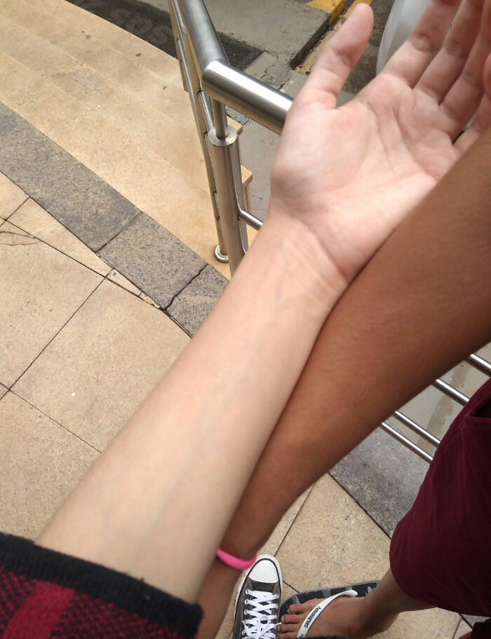 La diferencia entre mi color de piel y el de mi gemelo. Él sale a la calle, yo no