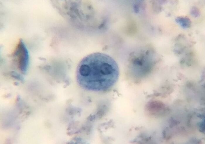 Esta ameba que vi a través del microscopio