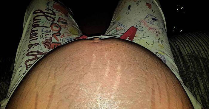 30 Mothers Are Sharing Realistic Pictures Of Baby Bumps And Pregnant Bodies To Fight Toxic Standards
