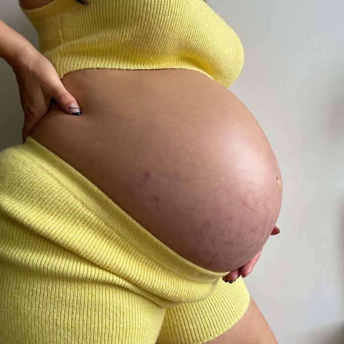 30 Mothers Are Sharing Realistic Pictures Of Baby Bumps And Pregnant Bodies To Fight Toxic Standards