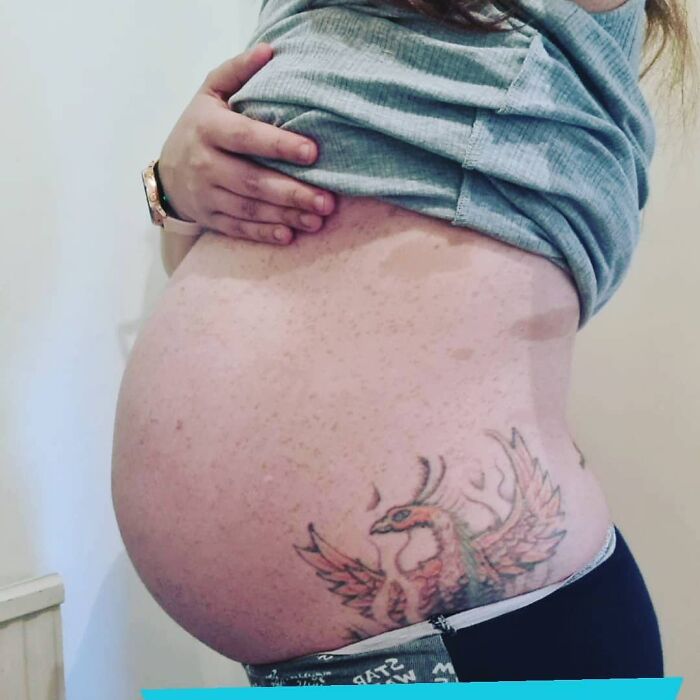 30 Mothers Are Sharing Realistic Pictures Of Baby Bumps And Pregnant Bodies To Fight Toxic Standards