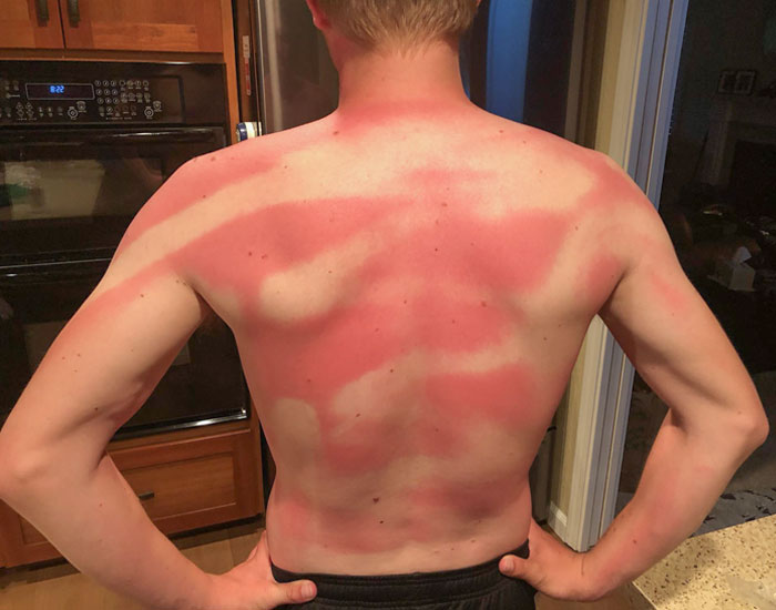 Mi esposa me ayudó a ponerme protector solar en la espalda en el día de playa de hoy. Dos veces