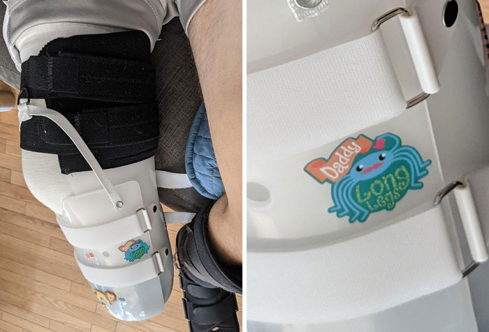 Acabo de perder el pie tras un accidente de moto. Esta es la pegatina que mi hijo eligió para decorar mi férula