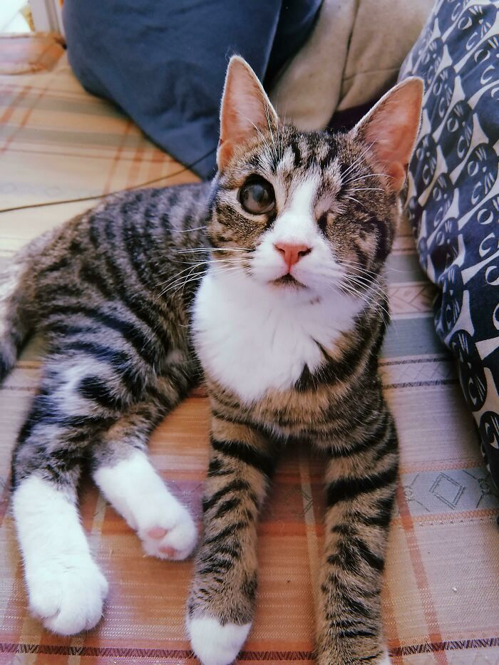 Mi bellleza de un ojo