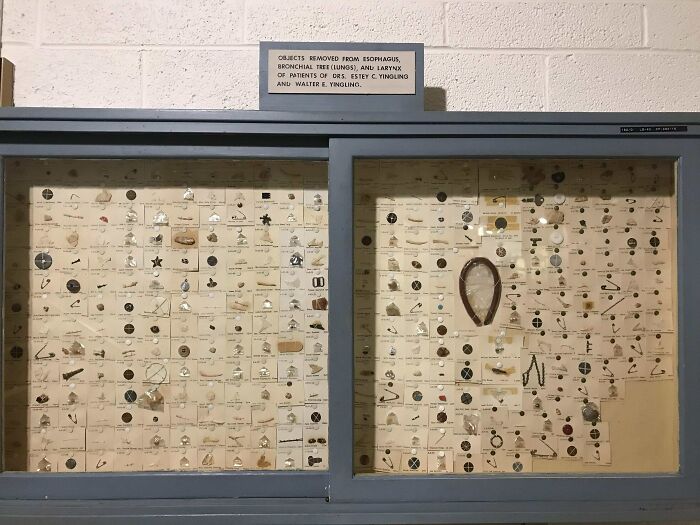 El museo de mi ciudad tiene una colección de objetos que los médicos han extraído de la garganta y los pulmones de los pacientes