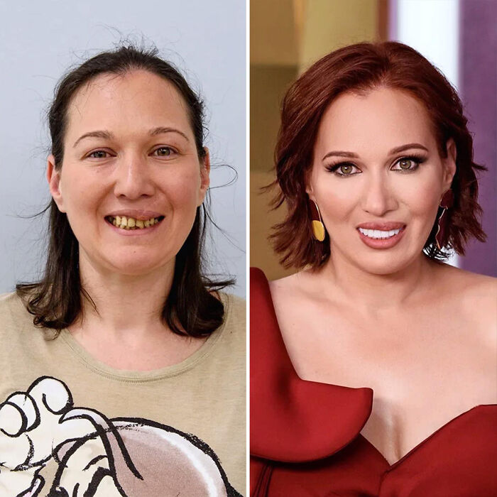 30 Transformations By This Hairstylist And His Team That Show The Power Of A Good Stylist (New Pics)