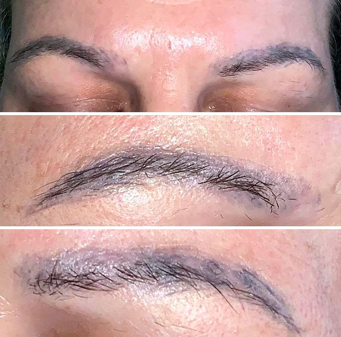 Mis horribles cejas. Mal microblading, tinta barata e instrucciones de cuidado posterior incorrectas. Mírenlas