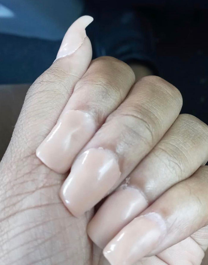 La amiga de mi hermana se hizo las uñas con una manicura “profesional”
