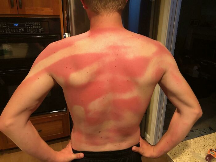 Mi esposa me ayudó a ponerme protector solar en la playa hoy (dos veces)