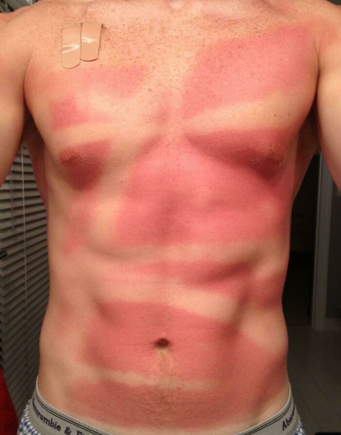 Cuidado al aplicar el protector solar en spray
