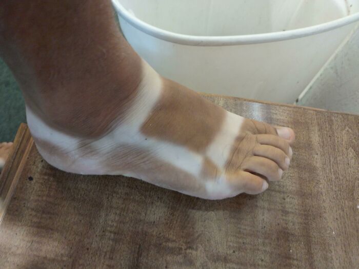 Las líneas de bronceado de mis pies