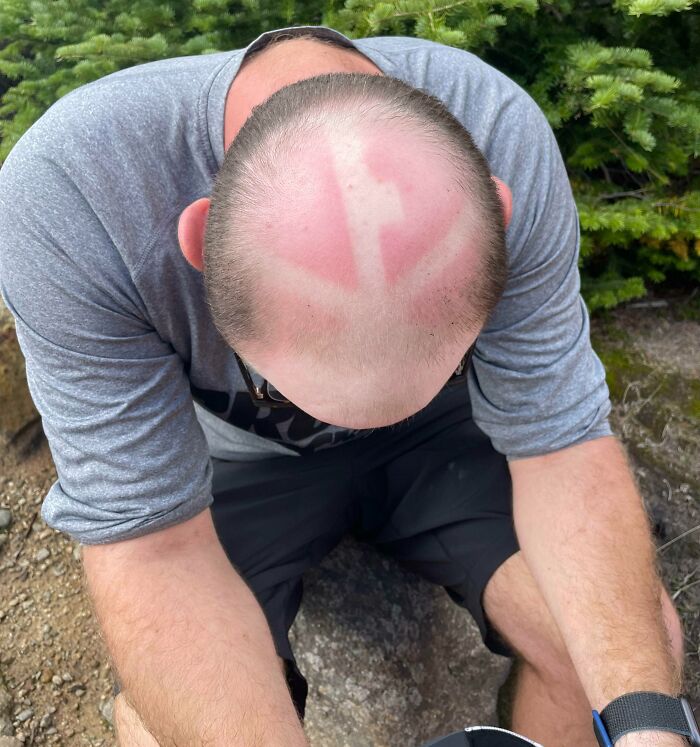 Llevé una gorra de malla en una caminata de 50 kilómetros. Hoy me siento como Aang