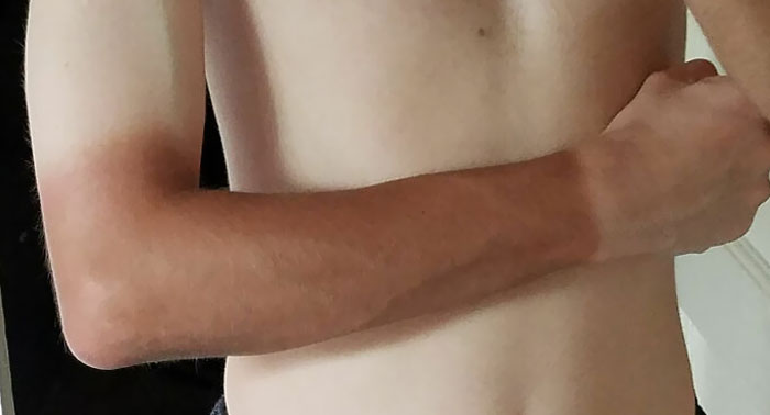 Tengo un nuevo trabajo en el que tengo que llevar uniforme y guantes mientras trabajo fuera, ahora tengo este aspecto