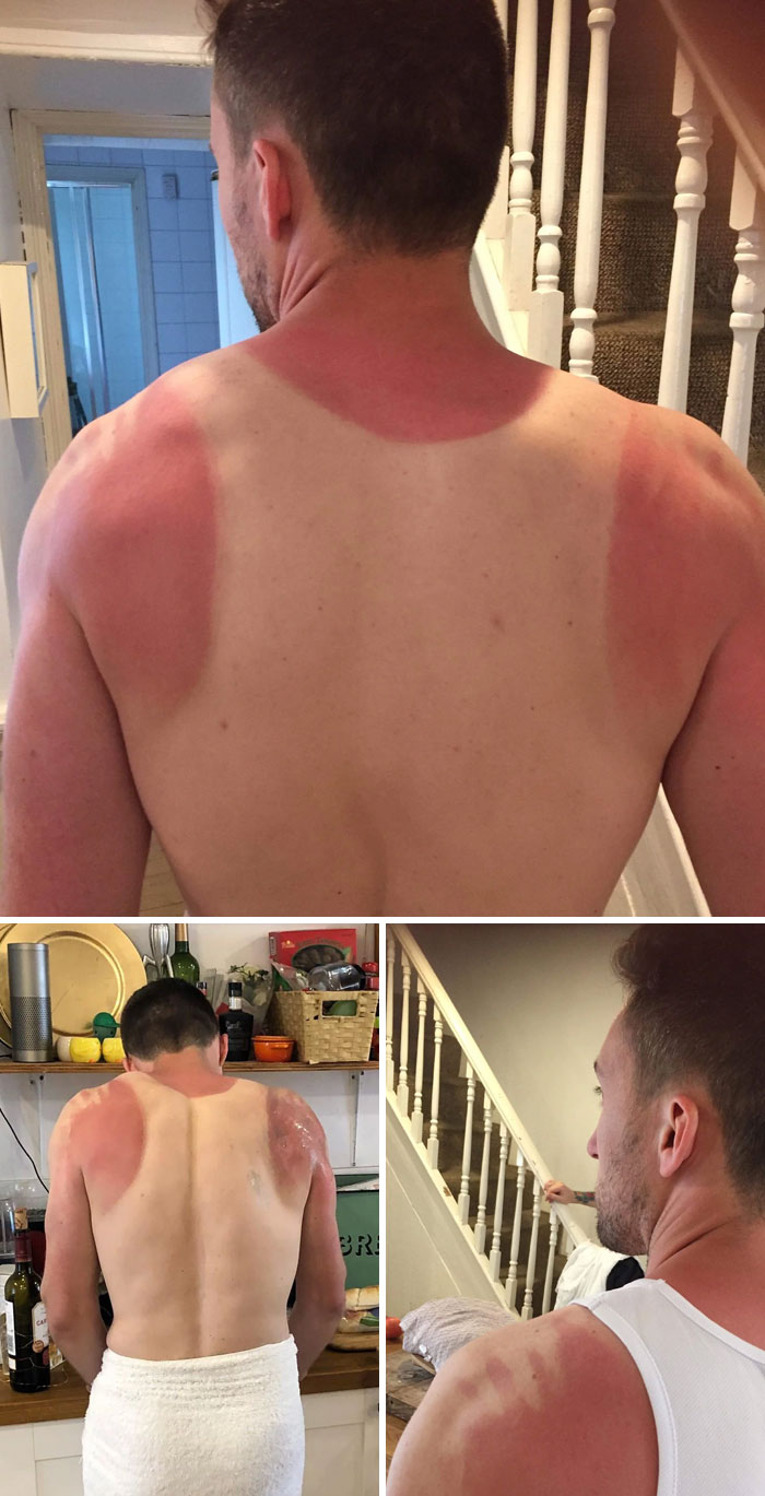Corrí el maratón de Londres hace un par de años. Creo que me faltó un poco de protección solar