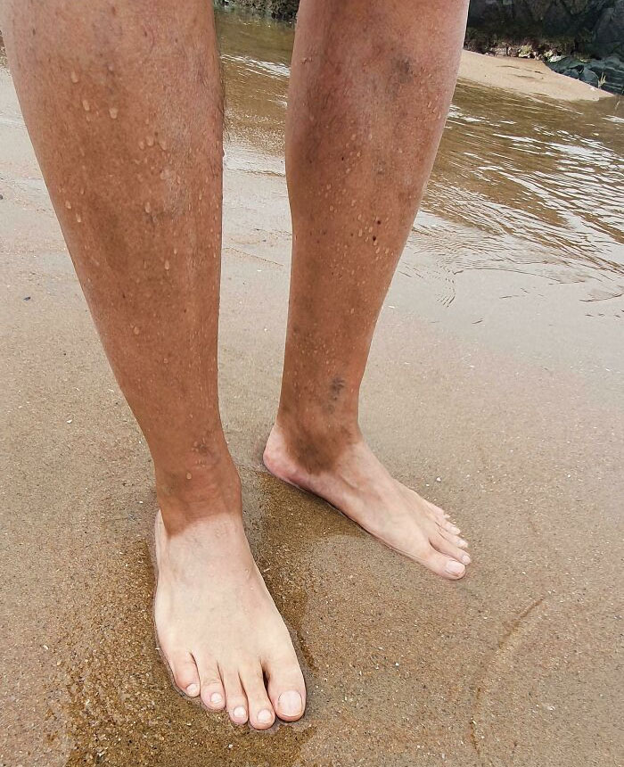 Los pies blancos y las piernas bronceadas de papá. Lleva los mismos zapatos todos los días