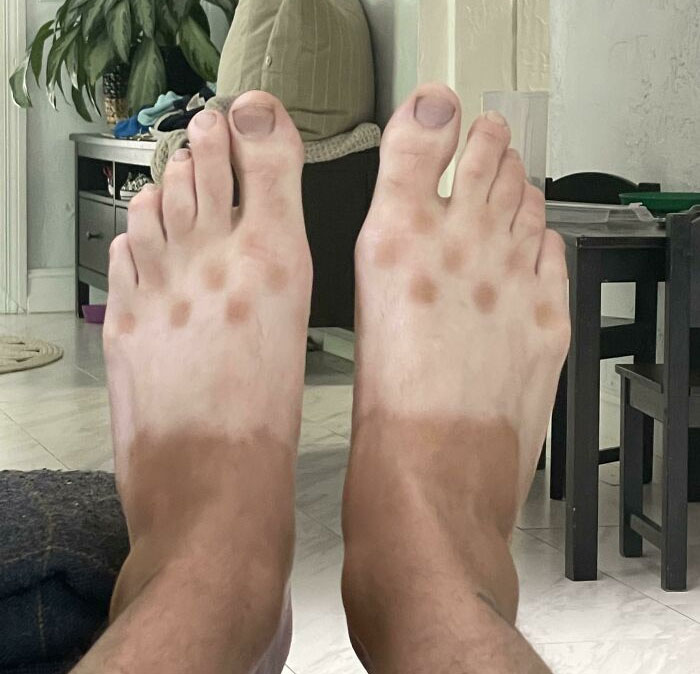 Mis bronceado de crocs