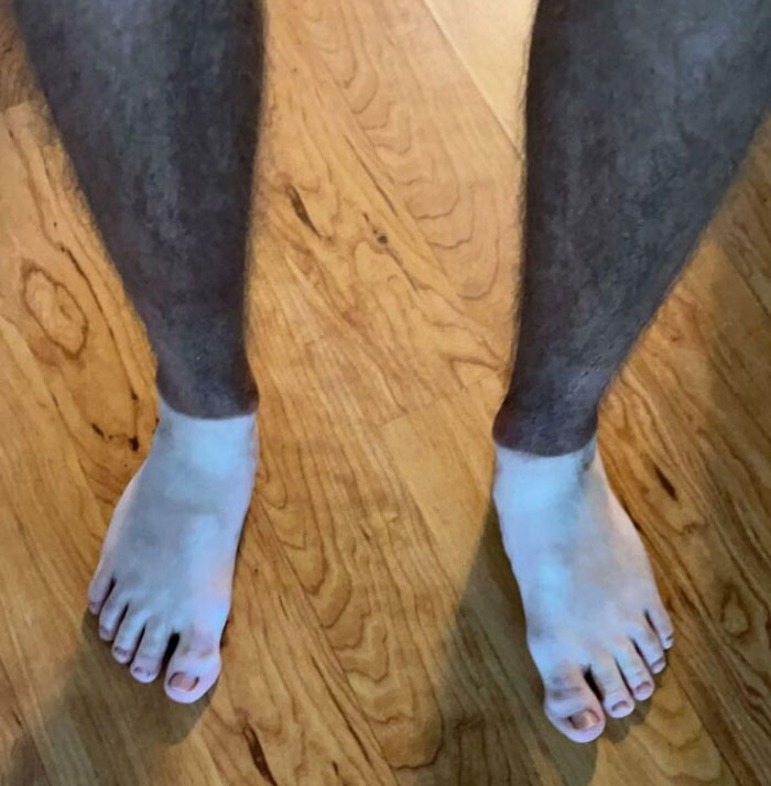 Mis líneas de bronceado hacen que parezca que llevo necropantalones 