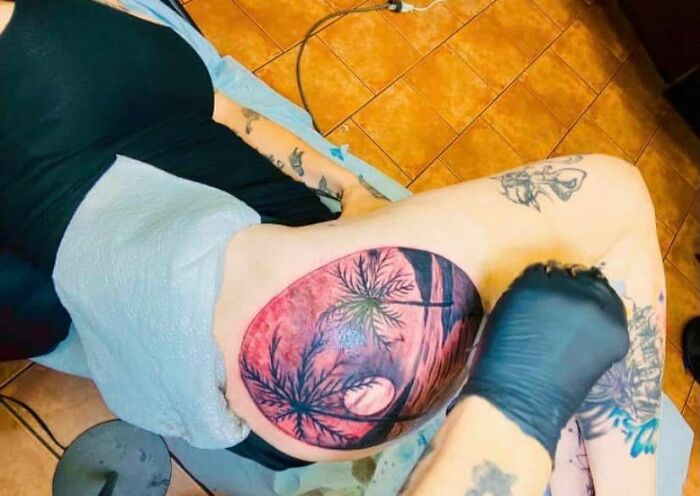 He visto un sarpullido en una nalga, y esto parece un sarpullido en una nalga