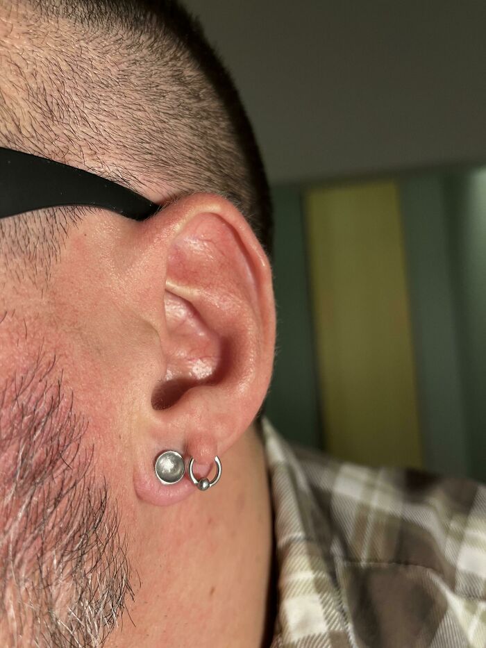 Nací con un poco de piel de más en la oreja, así que pensé que había que hacer algo