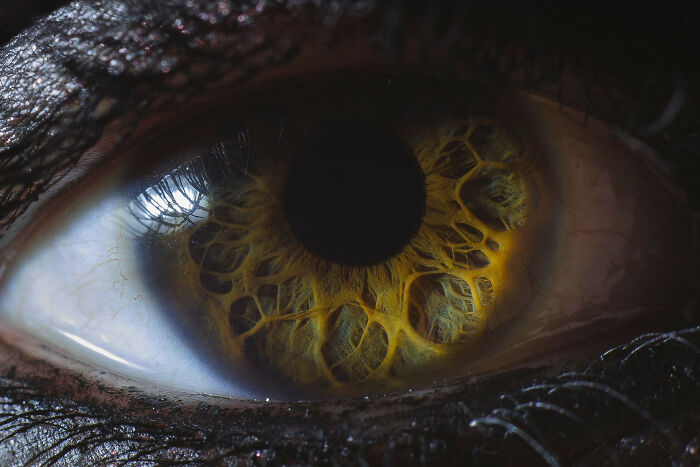 El ojo de mi mujer que su médico le dijo que era el más raro que había visto nunca