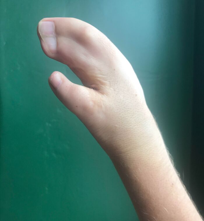 Esta es una foto de la mano con la que nací