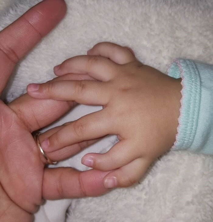 Mi hermana pequeña nació con seis dedos
