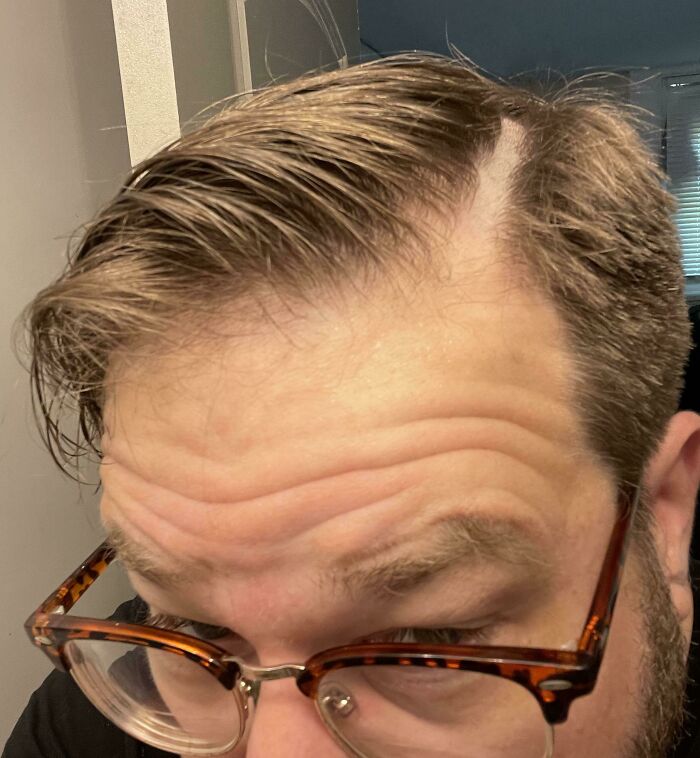Fui a un nuevo barbero. Pedí que me hiciera la raya ¡Me cortó una estúpida raya de 1cm en la cabeza!